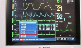 心电监护仪的操作视频,轻松掌握生命体征监测技巧
